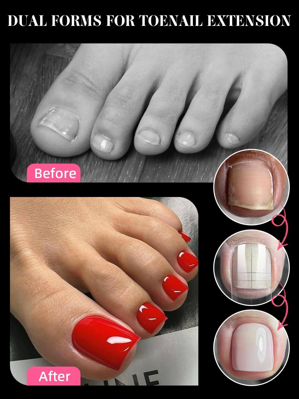 EBANKU 300PCS Toe Dual Nail Forms 15 Sizes Poly Gel Pedicure Kit