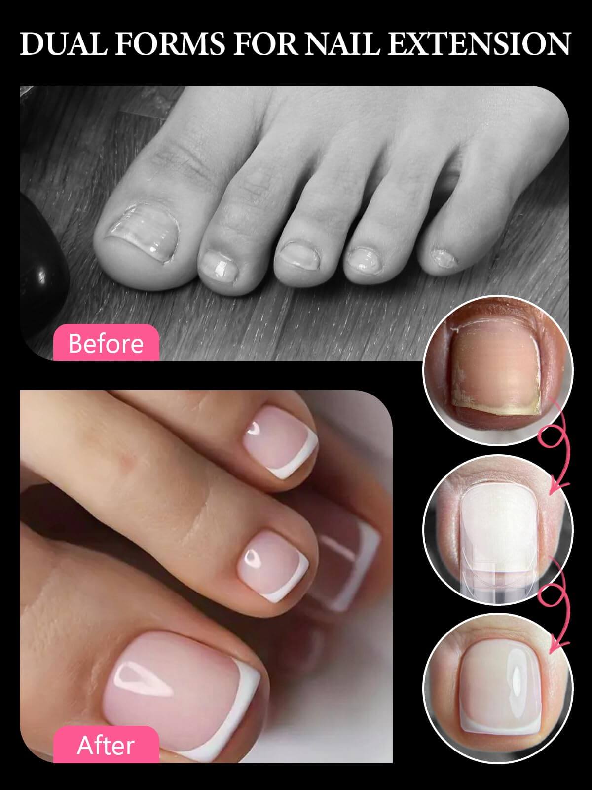 EBANKU Poly Gel Toe Nail Dual Forms Kit 120PCS with Clips